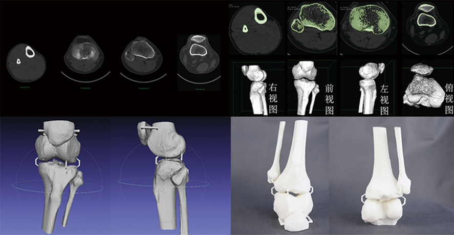 CT數(shù)據(jù)三維重建骨骼模型，骨骼模型精細(xì)化建模修復(fù)，骨骼模型3D打印快速成型